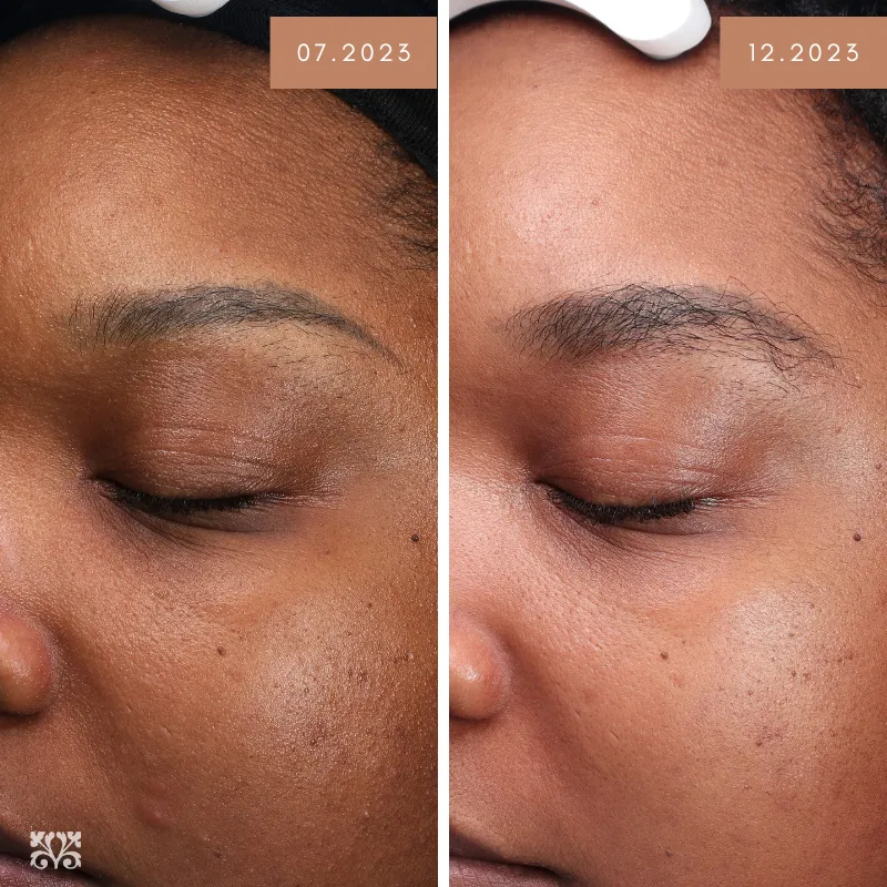 Obagi Nu-Cil Eyebrow Boosting Serum