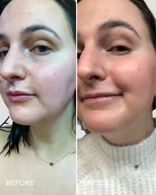Skin Hero Calendula   2% Bakuchiol Bio-Retinol Serum