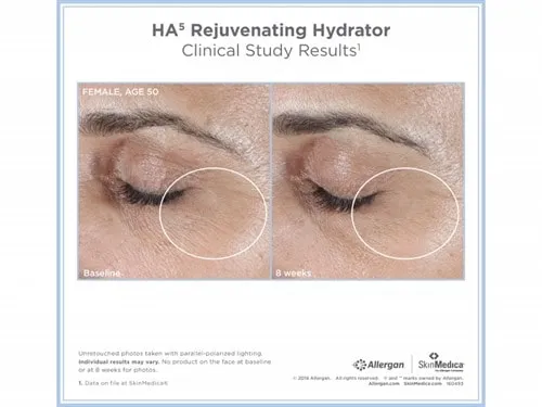 SkinMedica HA⁵® Rejuvenating Hydrator
