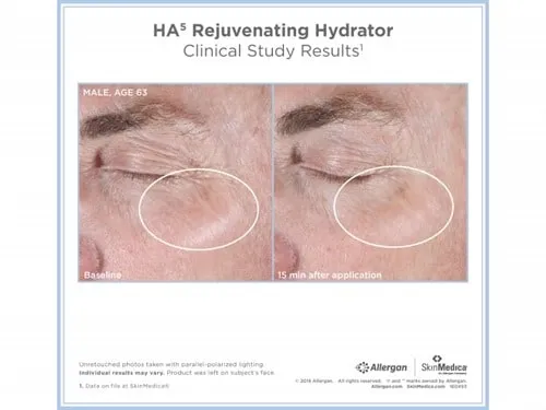 SkinMedica HA⁵® Rejuvenating Hydrator